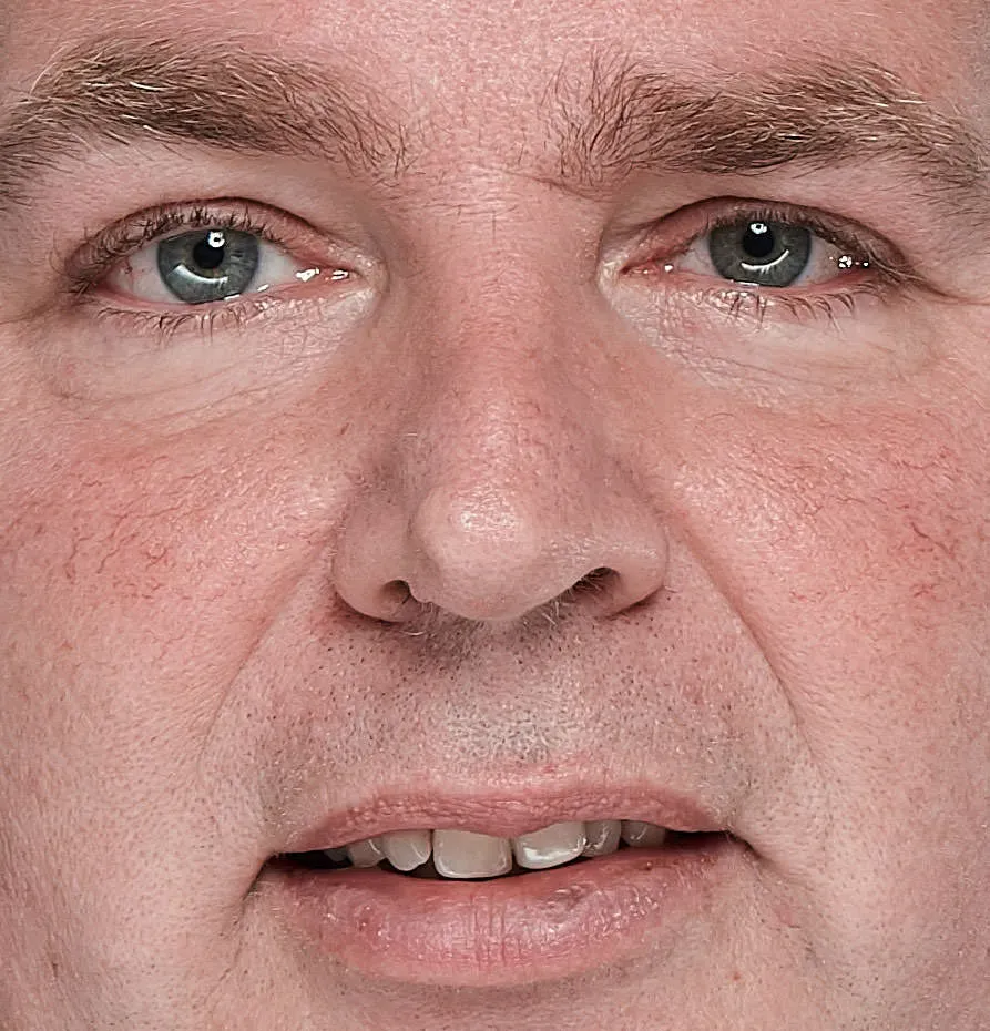 Het effect van de Eye-Lighter in de ogen